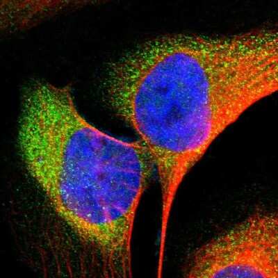Immunocytochemistry/ Immunofluorescence: Alkaline Phosphatase, Tissue Non-Specific Antibody [NBP1-91660]