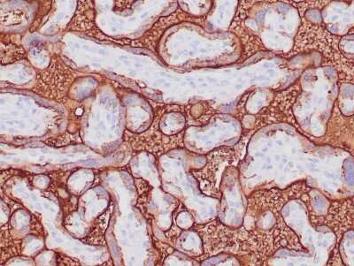 Immunohistochemistry-Paraffin: Alkaline Phosphatase/ALPP Antibody (ALP/870) - Azide and BSA Free [NBP2-47988]