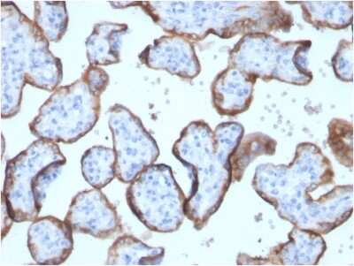 Immunohistochemistry-Paraffin: Alkaline Phosphatase/ALPP Antibody (ALPP/2899R) [NBP3-07800]