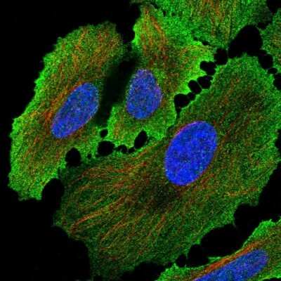 Immunocytochemistry/ Immunofluorescence: Alkaline Phosphatase/ALPP Antibody [NBP2-34056]