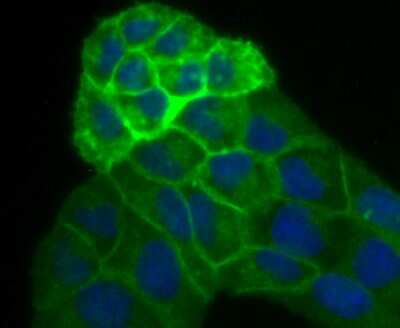 Immunocytochemistry/ Immunofluorescence: Alkaline Phosphatase/ALPP Antibody (JM22-53) [NBP2-67136]
