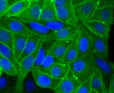 Immunocytochemistry/ Immunofluorescence: Alkaline Phosphatase/ALPP Antibody (JM22-53) [NBP2-67136]