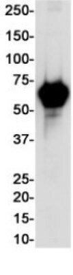 Western Blot: Alkaline Phosphatase/ALPP Antibody (S01-8I3) [NBP3-20050]