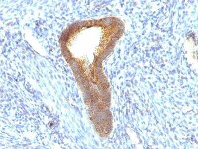 Immunohistochemistry-Paraffin: Alkaline Phosphatase, Tissue Non-Specific Antibody (ALPL/597) - Azide and BSA Free [NBP2-54376]