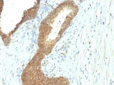 Immunohistochemistry-Paraffin: Alkaline Phosphatase, Tissue Non-Specific Antibody (ALPL/597) [NBP2-53240]