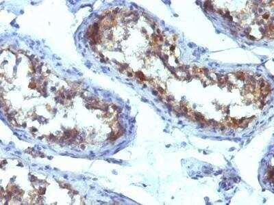Immunohistochemistry-Paraffin: Alkaline Phosphatase, Tissue Non-Specific Antibody (ALPL/597) [NBP2-53240]
