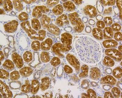 Immunohistochemistry-Paraffin: Alkaline Phosphatase, Tissue Non-Specific Antibody (SA40-00) [NBP2-67295]
