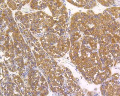 Immunohistochemistry-Paraffin: Alkaline Phosphatase, Tissue Non-Specific Antibody (SA40-00) [NBP2-67295]
