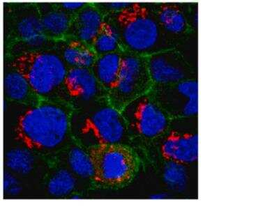 Immunocytochemistry/ Immunofluorescence: Alkaline Phosphatase, Tissue Non-Specific Antibody (TRA-2-49) - BSA Free [NB600-540]