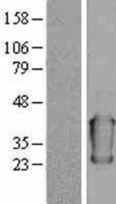 Western Blot: alpha 1-Acid Glycoprotein Overexpression Lysate [NBL1-13978]