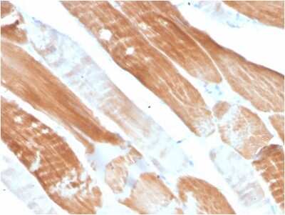 Immunohistochemistry-Paraffin: Alpha Actinin 2 Antibody (ACTN2/3291) - Azide and BSA Free [NBP3-08584]