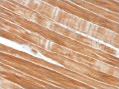 Immunohistochemistry-Paraffin: Alpha Actinin 2 Antibody (ACTN2/3292) - Azide and BSA Free [NBP2-79838]