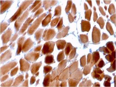 Immunohistochemistry-Paraffin: Alpha Actinin 2 Antibody (ACTN2/3292) - Azide and BSA Free [NBP2-79838]