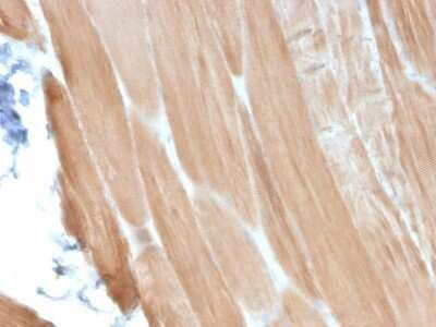 Immunohistochemistry-Paraffin: Alpha Actinin 2 Antibody (ACTN2/3293) - Azide and BSA Free [NBP2-79839]