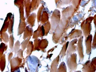 Immunohistochemistry-Paraffin: Alpha Actinin 2 Antibody (ACTN2/3293) [NBP2-79705]
