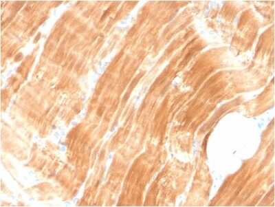 Immunohistochemistry-Paraffin: Alpha Actinin 2 Antibody (ACTN2/3294) - Azide and BSA Free [NBP3-08787]
