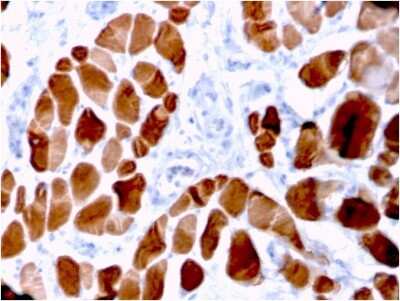 Immunohistochemistry-Paraffin: Alpha Actinin 2 Antibody (ACTN2/3294) - Azide and BSA Free [NBP3-08787]