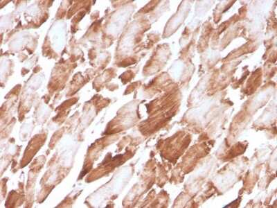 Immunohistochemistry-Paraffin: Alpha Actinin 2 Antibody (ACTN2/3294) - Azide and BSA Free [NBP3-08787]