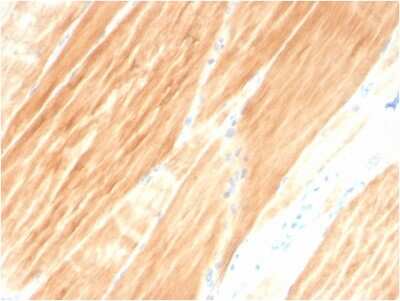 Immunohistochemistry-Paraffin: Alpha Actinin 2 Antibody (ACTN2/3295) [NBP3-07467]