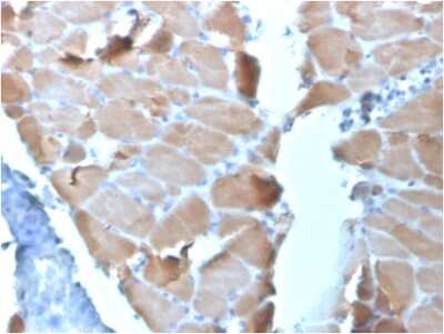 Immunohistochemistry-Paraffin: Alpha Actinin 2 Antibody (ACTN2/3295) [NBP3-07467]