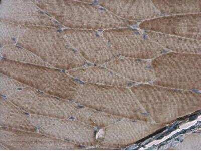 Immunohistochemistry-Paraffin: Alpha Actinin 2 Antibody [NBP1-32462]