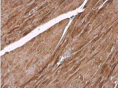 Immunohistochemistry-Paraffin: Alpha Actinin 2 Antibody [NBP1-32462]