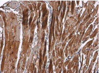 Immunohistochemistry-Paraffin: Alpha Actinin 2 Antibody [NBP1-32462]