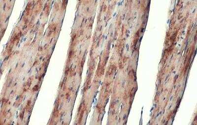 Immunohistochemistry-Paraffin: Alpha Actinin 2 Antibody [NBP1-32462]