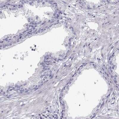 Immunohistochemistry-Paraffin: Alpha Actinin 2 Antibody [NBP1-90376]