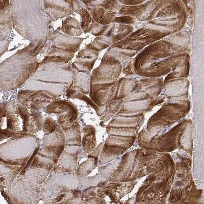 Immunohistochemistry-Paraffin: Alpha Actinin 2 Antibody [NBP1-90376]