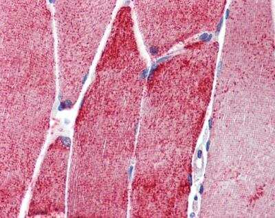 Immunohistochemistry-Paraffin: Alpha Actinin 3 Antibody [NBP1-55292]