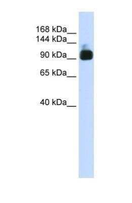 Western Blot: Alpha Actinin 3 Antibody [NBP1-55292]