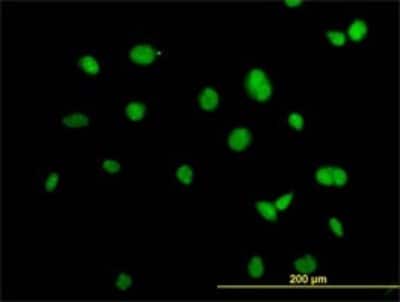 Immunocytochemistry/ Immunofluorescence: Alpha Actinin 4 Antibody (4D10) [H00000081-M01]