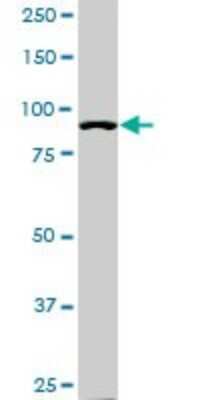 Western Blot: Alpha Actinin 4 Antibody (4D10) [H00000081-M01]