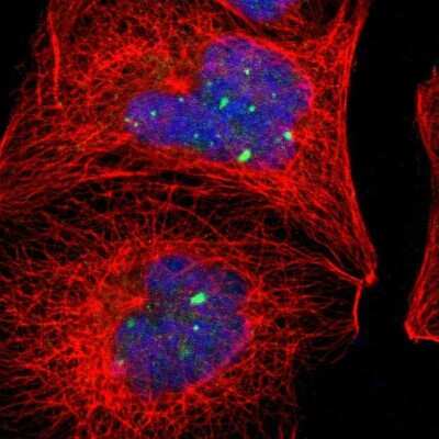 Immunocytochemistry/ Immunofluorescence: Alpha Actinin 4 Antibody [NBP1-89818]
