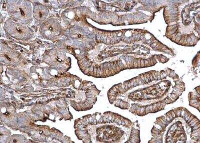 Immunohistochemistry-Paraffin: Alpha Actinin 4 Antibody [NBP2-15357]
