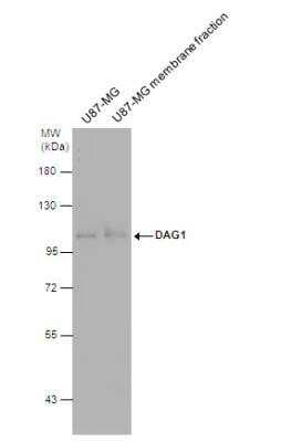 Western Blot: Dystroglycan Antibody [NBP2-14868]
