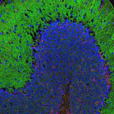 Immunohistochemistry: Alpha Fodrin Antibody (3D7) [NBP1-92689]