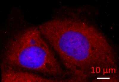 Immunocytochemistry/ Immunofluorescence: Alpha Fodrin Antibody [NBP1-53093]