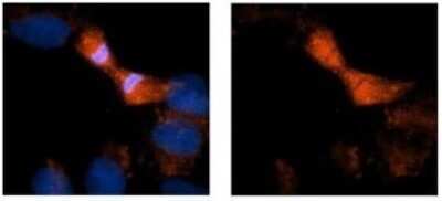Immunohistochemistry: Alpha Fodrin Antibody [NBP1-53093]