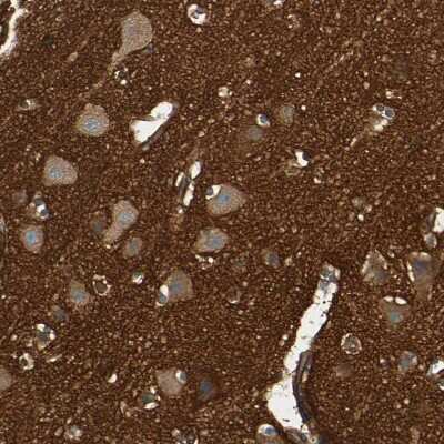 Immunohistochemistry-Paraffin: Alpha Fodrin Antibody [NBP1-89460]