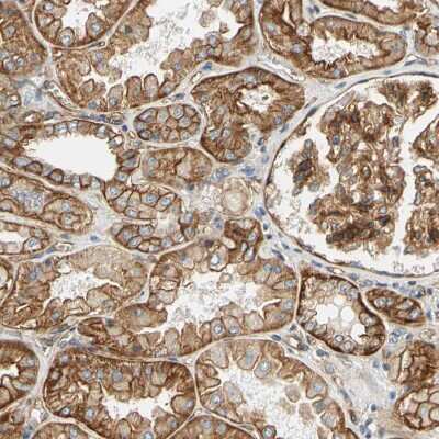 Immunohistochemistry-Paraffin: Alpha Fodrin Antibody [NBP1-89460]