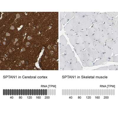 Immunohistochemistry-Paraffin: Alpha Fodrin Antibody [NBP1-89460]