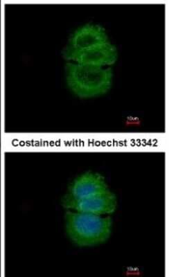 Immunocytochemistry/ Immunofluorescence: Alpha-TTP Antibody [NBP2-14870]