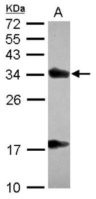 Western Blot: Alpha-TTP Antibody [NBP2-14870]