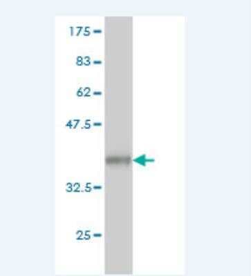 Western Blot: Alpha-mannosidase II Antibody (1G9) [H00004124-M01]