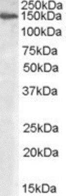 Western Blot: Alpha-mannosidase II Antibody [NB100-93414]