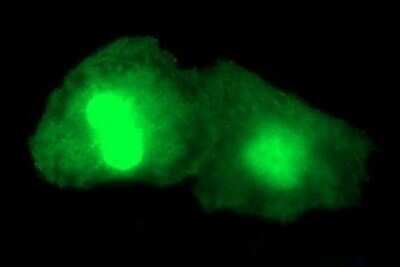 Immunocytochemistry/ Immunofluorescence: Alpha-parvin/Actopaxin Antibody (OTI1C10) - Azide and BSA Free [NBP2-72018]