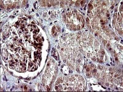 Immunohistochemistry: Alpha-parvin/Actopaxin Antibody (OTI1C10) - Azide and BSA Free [NBP2-72018]