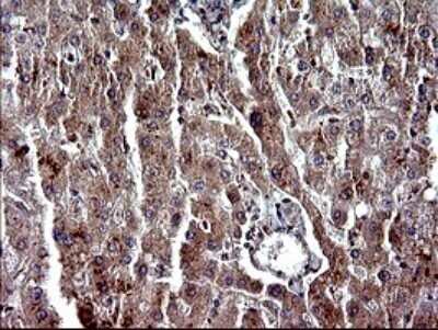 Immunohistochemistry: Alpha-parvin/Actopaxin Antibody (OTI1C10) - Azide and BSA Free [NBP2-72018]